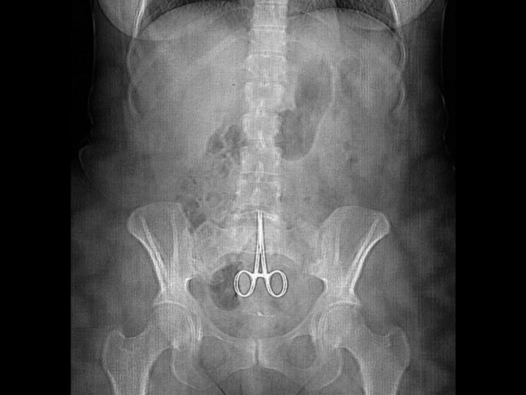 scissors